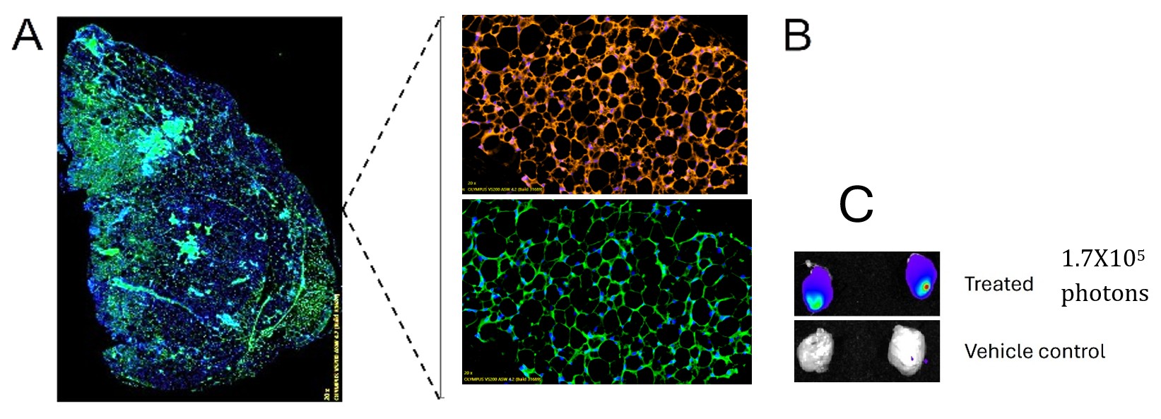 Full-length dystrophin delivery and muscle expression